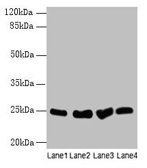 SOCS3 Antibody - Western blot All lanes: Socs3 antibody at 12µg/ml Lane 1: K562 whole cell lysate Lane 2: A375 whole cell lysate Lane 3: Hela whole cell lysate Lane 4: HepG2 whole cell lysate Secondary Goat polyclonal to rabbit IgG at 1/10000 dilution Predicted band size: 25 kDa Observed band size: 25 kDa