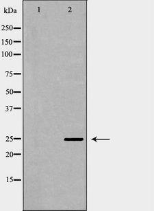 SOCS3 Antibody - Western blot analysis of K562 lysate using SOCS3 antibody. The lane on the left is treated with the antigen-specific peptide.