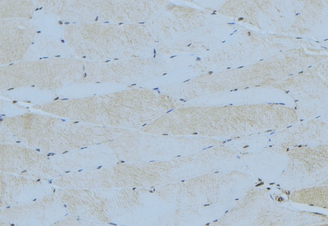 SOCS3 Antibody - 1:100 staining mouse muscle tissue by IHC-P. The sample was formaldehyde fixed and a heat mediated antigen retrieval step in citrate buffer was performed. The sample was then blocked and incubated with the antibody for 1.5 hours at 22°C. An HRP conjugated goat anti-rabbit antibody was used as the secondary.