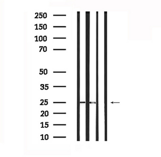 SOCS3 Antibody - Western blot analysis of extracts of HepG2 and rat brain tissue using SOCS3 antibody.