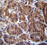 SOCS4 Antibody - SOCS4 Antibody immunohistochemistry of formalin-fixed and paraffin-embedded human stomach tissue followed by peroxidase-conjugated secondary antibody and DAB staining.