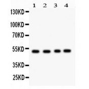 SOCS4 Antibody - SOCS4 antibody Western blot. All lanes: Anti SOCS4 at 0.5 ug/ml. Lane 1: MCF-7 Whole Cell Lysate at 40 ug. Lane 2: SW620 Whole Cell Lysate at 40 ug. Lane 3: HELA Whole Cell Lysate at 40 ug. Lane 4: SKOV Whole Cell Lysate at 40 ug. Predicted band size: 51 kD. Observed band size: 51 kD.