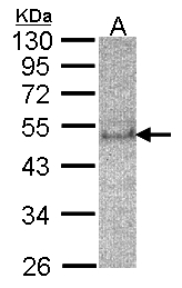 SOCS4 Antibody - Sample (30 ug of whole cell lysate). A: HeLa S3. 12% SDS PAGE. SOCS-7 / SOCS4 antibody diluted at 1:200