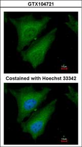 SOCS4 Antibody - Immunofluorescence of paraformaldehyde-fixed HeLa using SOCS4 antibody at 1:200 dilution.