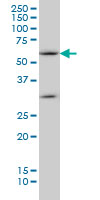 SOCS5 Antibody - SOCS5 monoclonal antibody (M01), clone 2D1 Western blot of SOCS5 expression in HepG2.