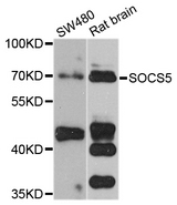SOCS5 Antibody - Western blot analysis of extracts of various cell lines.