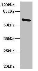 SOCS5 Antibody - Western blot All Lanes: SOCS5 antibody IgG at 1.83ug/ml+ 293T whole cell lysate Secondary Goat polyclonal to rabbit IgG at 1/10000 dilution Predicted band size: 61 kDa Observed band size: 61 kDa