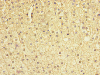 SOCS5 Antibody - Immunohistochemistry of paraffin-embedded human adrenal gland tissue at dilution 1:100