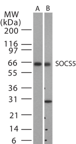 SOCS5 Antibody - Western blot analysis for SOCS5 using antibody at 1:500 dilution against 15 ug/lane of mouse spleen (lane A) and human spleen (lane B) lysates.