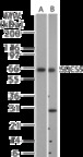 SOCS5 Antibody - Western blot analysis for SOCS5 using antibody at 1:500 dilution against 15 ug/lane of mouse spleen (lane A) and human spleen (lane B) lysates.