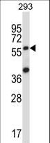 SOCS6 / SOCS-6 Antibody - SOCS6 Antibody western blot of 293 cell line lysates (35 ug/lane). The SOCS6 antibody detected the SOCS6 protein (arrow).