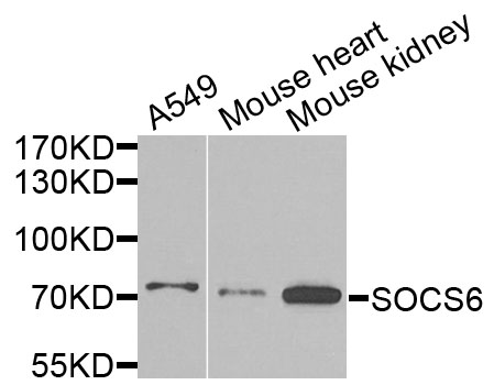 SOCS6 / SOCS-6 Antibody - Western blot analysis of extracts of various cells.