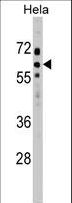 SOCS7 / SOCS-7 Antibody - SOCS7 Antibody western blot of HeLa cell line lysates (35 ug/lane). The SOCS7 antibody detected the SOCS7 protein (arrow).