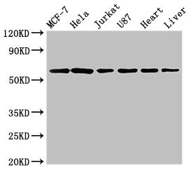 SOCS7 / SOCS-7 Antibody - Western Blot Positive WB detected in:MCF-7 whole cell lysate,Hela whole cell lysate,Jurkat whole cell lysate,U87 whole cell lysate,Rat heart tissue,Rat liver tissue All Lanes:SOCS7 antibody at 3µg/ml Secondary Goat polyclonal to rabbit IgG at 1/50000 dilution Predicted band size: 63,38 KDa Observed band size: 63 KDa