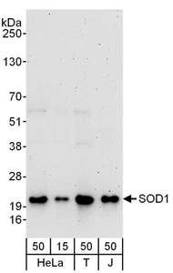 SOD1 / Cu-Zn SOD Antibody - Detection of Human SOD1 by Western Blot. Samples: Whole cell lysate from HeLa (15 and 50 ug), 293T (T; 50 ug) and Jurkat (J; 50 ug) cells. Antibodies: Affinity purified rabbit anti-SOD1 antibody used for WB at 0.1 ug/ml. Detection: Chemiluminescence with an exposure time of 3 minutes.