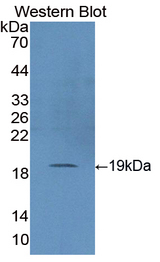 SOD1 / Cu-Zn SOD Antibody - Western blot of SOD1 / Cu-Zn SOD antibody.