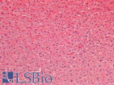 SOD1 / Cu-Zn SOD Antibody - Human Liver: Formalin-Fixed, Paraffin-Embedded (FFPE)