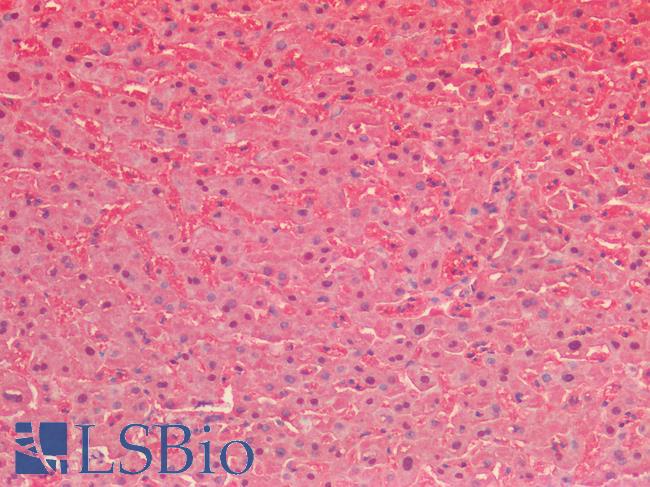 SOD1 / Cu-Zn SOD Antibody - Human Liver: Formalin-Fixed, Paraffin-Embedded (FFPE)