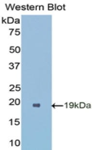 SOD1 / Cu-Zn SOD Antibody - Western blot of recombinant SOD1 / SOD.  This image was taken for the unconjugated form of this product. Other forms have not been tested.