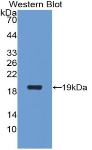 SOD1 / Cu-Zn SOD Antibody - Western blot of recombinant SOD1 / SOD.  This image was taken for the unconjugated form of this product. Other forms have not been tested.