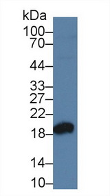 SOD1 / Cu-Zn SOD Antibody - Western Blot; Sample: Human Jurkat cell lysate; Primary Ab: 3µg/ml Rabbit Anti-Gallus SOD1 Antibody Second Ab: 0.2µg/mL HRP-Linked Caprine Anti-Rabbit IgG Polyclonal Antibody