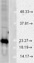 SOD1 / Cu-Zn SOD Antibody - Western blot analysis of Cu/Zn SOD in a human cell line mix, using a 1:1000 dilution of SOD1 / SOD antibody.  This image was taken for the unconjugated form of this product. Other forms have not been tested.
