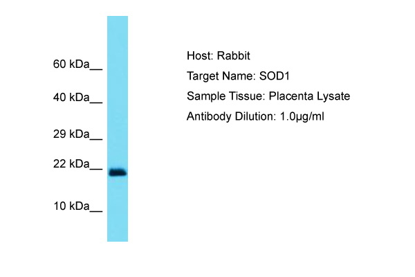 SOD1 / Cu-Zn SOD Antibody -  This image was taken for the unconjugated form of this product. Other forms have not been tested.
