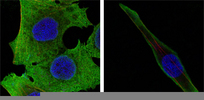 SOD1 / Cu-Zn SOD Antibody - Confocal immunofluorescence of PANC-1 (left) and SKBR-3 (right) cells using SOD1 mouse monoclonal antibody (green). Red: Actin filaments have been labeled with DY-554 phalloidin. Blue: DRAQ5 fluorescent DNA dye.
