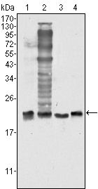 SOD1 / Cu-Zn SOD Antibody - SOD1 Antibody in Western Blot (WB)