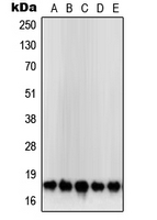 SOD1 / Cu-Zn SOD Antibody - Western blot analysis of SOD1 expression in HeLa (A); MCF7 (B); Jurkat (C); HepG2 (D); DU145 (E) whole cell lysates.