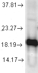 SOD1 / Cu-Zn SOD Antibody - Detection of Cu/Zn SOD in a mixture of human cell lines.
