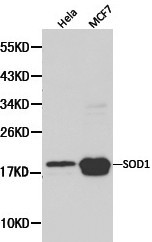 SOD1 / Cu-Zn SOD Antibody - Western blot of SOD1 pAb in extracts from Hela and MCF7 cells.