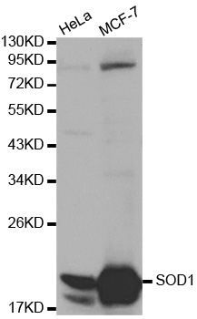 SOD1 / Cu-Zn SOD Antibody - Western blot analysis of extracts of various cell lines, using SOD1 antibody at 1:1000 dilution. The secondary antibody used was an HRP Goat Anti-Rabbit IgG (H+L) at 1:10000 dilution. Lysates were loaded 25ug per lane and 3% nonfat dry milk in TBST was used for blocking.