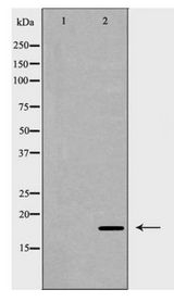 SOD1 / Cu-Zn SOD Antibody - Western blot of SOD1 expression in Jurkat cells