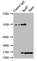 SOD1 / Cu-Zn SOD Antibody - Immunoprecipitating SOD1 in HEK293 whole cell lysate Lane 1: Rabbit control IgG instead of ARG1 Antibody in HEK293 whole cell lysate.For western blotting, a HRP-conjugated Protein G antibody was used as the secondary antibody (1/2000) Lane 2: ARG1 Antibody (8µg) + HEK293 whole cell lysate (500µg) Lane 3: HEK293 whole cell lysate (10µg)