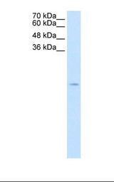 SOD1 / Cu-Zn SOD Antibody - Jurkat cell lysate. Antibody concentration: 2.5 ug/ml. Gel concentration: 15%.  This image was taken for the unconjugated form of this product. Other forms have not been tested.