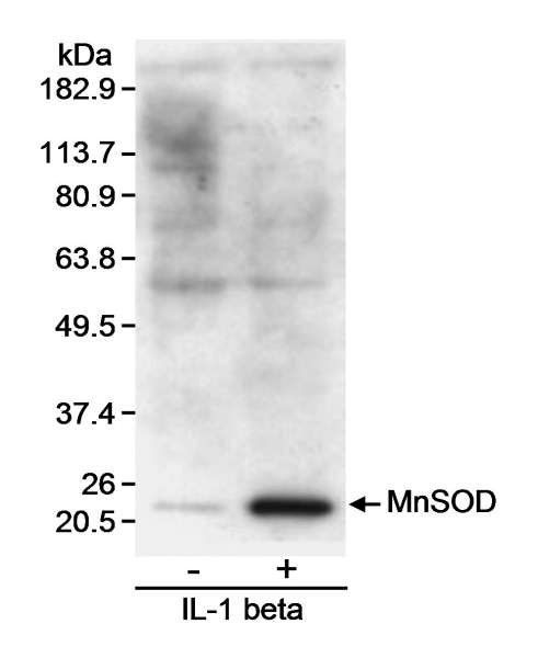 SOD2 / Mn SOD Antibody - Detection of MnSOD by Western Blot. Samples: Whole cell lysate (30 ug) from rat vascular smooth muscle cells treated with IL-1 beta (3 ng/ml) for 24 hours (+) or untreated (-). Antibody: Affinity purified goat anti-MnSOD (BL468G; ) used at 0.4 ug/ml. Detection: Chemiluminescence with 3 minute exposure.