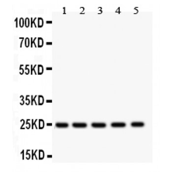 SOD2 / Mn SOD Antibody - SOD2 antibody Western blot. All lanes: Anti SOD2 at 0.5 ug/ml. Lane 1: Mouse Testis Tissue Lysate at 50 ug. Lane 2: Mouse Lung Tissue Lysate at 50 ug. Lane 3: Mouse Cardiac Muscle Tissue Lysate at 50 ug. Lane 4: Mouse Liver Tissue Lysate at 50 ug. Lane 5: HEPG2 Whole Cell Lysate at 40 ug. Predicted band size: 25 kD. Observed band size: 25 kD.