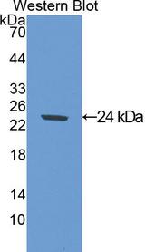 SOD2 / Mn SOD Antibody