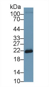 SOD2 / Mn SOD Antibody