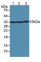 SOD2 / Mn SOD Antibody - Western Blot; Sample: Lane1: Mouse Heart Tissue; Lane2: Mouse Liver Tissue; Lane3: Rat Brain Tissue.
