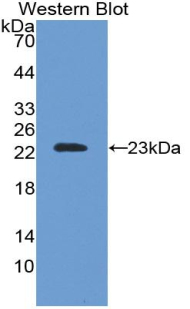 SOD2 / Mn SOD Antibody - Western blot of recombinant MNSOD / SOD2.  This image was taken for the unconjugated form of this product. Other forms have not been tested.