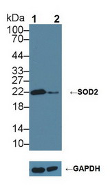 SOD2 / Mn SOD Antibody - Knockout Varification: Lane 1: Wild-type Hela cell lysate; Lane 2: SOD2 knockout Hela cell lysate; Predicted MW: 25kDa Observed MW: 22kDa Primary Ab: 1µg/ml Rabbit Anti-Rat SOD2 Antibody Second Ab: 0.2µg/mL HRP-Linked Caprine Anti-Rabbit IgG Polyclonal Antibody