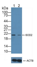 SOD2 / Mn SOD Antibody - Knockout Varification: Lane 1: Wild-type MCF7 cell lysate; Lane 2: SOD2 knockout MCF7 cell lysate; Predicted MW: 18,20,21,25kd Observed MW: 21kd Primary Ab: 3µg/ml Rabbit Anti-Human SOD2 Antibody Second Ab: 0.2µg/mL HRP-Linked Caprine Anti-Rabbit IgG Polyclonal Antibody
