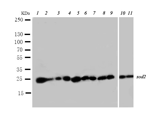 SOD2 / Mn SOD Antibody - WB of MNSOD / SOD2 antibody. Lane 1: Rat Liver Tissue Lysate. Lane 2: Rat Intestines Tissue Lysate. Lane 3: Rat Lung Tissue Lysate. Lane 4: Rat Heart Tissue Lysate. Lane 5: SMMC Cell Lysate . Lane 6: HELA Cell Lysate. Lane 7: COLO320 Cell Lysate. Lane 8: SW620 Cell Lysate . Lane 9: A549 Cell Lysate.
