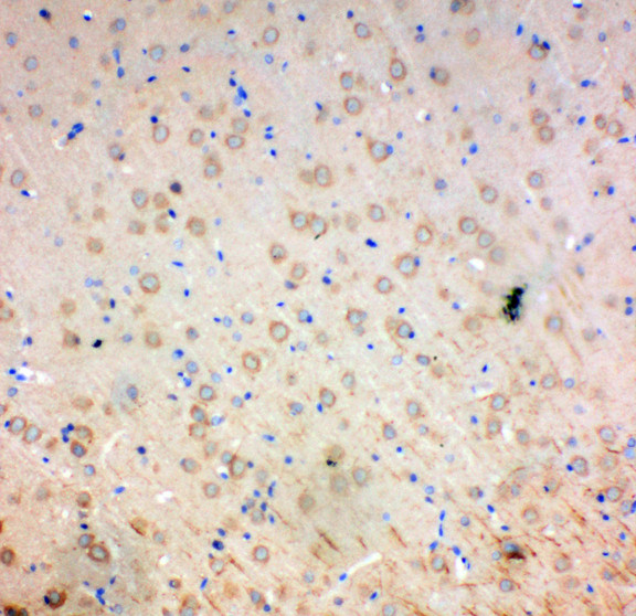 SOD2 / Mn SOD Antibody - MNSOD / SOD2 antibody. IHC(P): Rat Brain Tissue.
