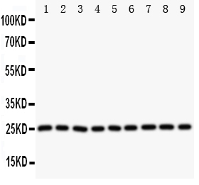 SOD2 / Mn SOD Antibody - Western blot analysis of SOD2/Mnsod using anti-SOD2/Mnsod antibody. Electrophoresis was performed on a 5-20% SDS-PAGE gel at 70V (Stacking gel) / 90V (Resolving gel) for 2-3 hours. The sample well of each lane was loaded with 50ug of sample under reducing conditions. Lane 1: Rat Liver Tissue Lysate, Lane 2: Rat Intestine Tissue Lysate, Lane 3: Rat Lung Tissue Lysate, Lane 4: Rat Heart Tissue Lysate, Lane 5: SMMC Whole Cell Lysate, Lane 6: HELA Whole Cell Lysate, Lane 7: COLO320 Whole Cell Lysate, Lane 8: SW620 Whole Cell Lysate, Lane 9: A549 Whole Cell Lysate. After Electrophoresis, proteins were transferred to a Nitrocellulose membrane at 150mA for 50-90 minutes. Blocked the membrane with 5% Non-fat Milk/ TBS for 1.5 hour at RT. The membrane was incubated with rabbit anti-SOD2/Mnsod antigen affinity purified polyclonal antibody at 0.5 µg/mL overnight at 4°C, then washed with TBS-0.1% Tween 3 times with 5 minutes each and probed with a goat anti-rabbit IgG-HRP secondary antibody at a dilution of 1:10000 for 1.5 hour at RT. The signal is developed using an Enhanced Chemiluminescent detection (ECL) kit with Tanon 5200 system. A specific band was detected for SOD2/Mnsod at approximately 25KD. The expected band size for SOD2/Mnsod is at 25KD.