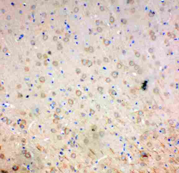 SOD2 / Mn SOD Antibody - IHC analysis of SOD2/Mnsod using anti-SOD2/Mnsod antibody. SOD2/Mnsod was detected in paraffin-embedded section of rat brain tissues. Heat mediated antigen retrieval was performed in citrate buffer (pH6, epitope retrieval solution) for 20 mins. The tissue section was blocked with 10% goat serum. The tissue section was then incubated with 1µg/ml rabbit anti-SOD2/Mnsod Antibody overnight at 4°C. Biotinylated goat anti-rabbit IgG was used as secondary antibody and incubated for 30 minutes at 37°C. The tissue section was developed using Strepavidin-Biotin-Complex (SABC) with DAB as the chromogen.