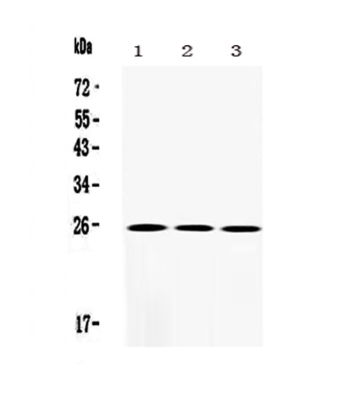 SOD2 / Mn SOD Antibody - Western blot analysis of SOD2/Mnsod using anti-SOD2/Mnsod antibody. Electrophoresis was performed on a 5-20% SDS-PAGE gel at 70V (Stacking gel) / 90V (Resolving gel) for 2-3 hours. The sample well of each lane was loaded with 50ug of sample under reducing conditions. Lane 1: mouse liver tissue lysates, Lane 2: mouse small intestine tissue lysates, Lane 3: mouse lung tissue lysates. After Electrophoresis, proteins were transferred to a Nitrocellulose membrane at 150mA for 50-90 minutes. Blocked the membrane with 5% Non-fat Milk/ TBS for 1.5 hour at RT. The membrane was incubated with rabbit anti-SOD2/Mnsod antigen affinity purified polyclonal antibody at 0.5 µg/mL overnight at 4°C, then washed with TBS-0.1% Tween 3 times with 5 minutes each and probed with a goat anti-rabbit IgG-HRP secondary antibody at a dilution of 1:10000 for 1.5 hour at RT. The signal is developed using an Enhanced Chemiluminescent detection (ECL) kit with Tanon 5200 system. A specific band was detected for SOD2/Mnsod at approximately 25KD. The expected band size for SOD2/Mnsod is at 25KD.