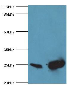 SOD2 / Mn SOD Antibody - Western blot. All lanes: SOD2 antibody at 2 ug/ml. Lane 1: HeLa whole cell lysate Lane 2: mouse liver tissue. Secondary antibody: goat polyclonal to rabbit at 1:10000 dilution. Predicted band size: 25 kDa. Observed band size: 25 kDa.  This image was taken for the unconjugated form of this product. Other forms have not been tested.